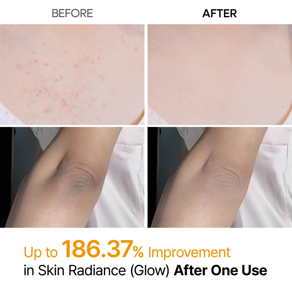 Let your skin BRIGHT